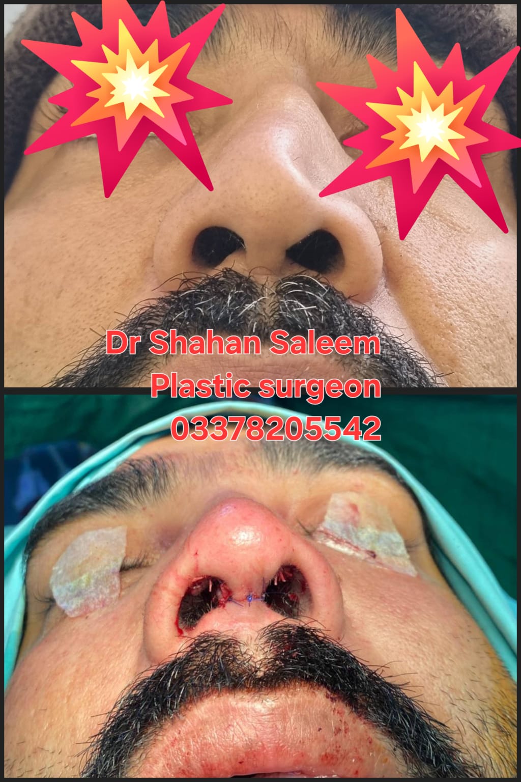 Before & After 18